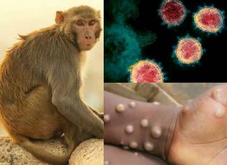 Oamenii de stiinta sustin ca un vaccin putin studiat poate opri variola maimutelor