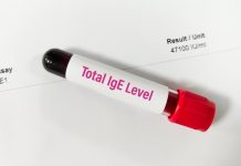 Ce este IgE total și ce indică?